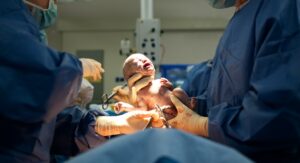 Child birth thru caesarian section.